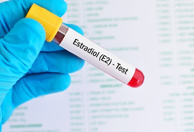 E2 ( ESTRADİOL) Testi Hakkında Faydalı Bilgiler